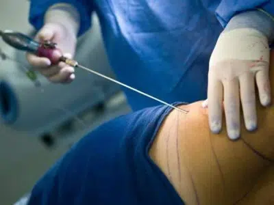 chirurgie esthétique